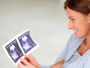 8 semanas de embarazo 8 semanas de embarazo